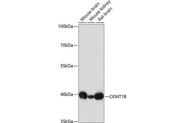CKMT1B Antikörper  (AA 1-85)