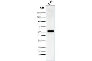 Image no. 1 for anti-Fascin (FSCN1) antibody (ABIN6940609)