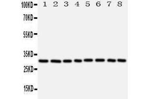 anti-Voltage-Dependent Anion Channel 1 (VDAC1) (AA 163-178), (Middle Region) antibody