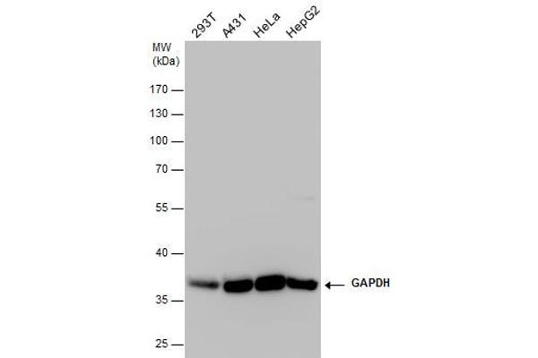 anti-Glyceraldehyde-3-Phosphate Dehydrogenase (GAPDH) (Center) antibody