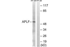 Image no. 2 for anti-Aprataxin and PNKP Like Factor (APLF) (Ser116) antibody (ABIN1848316)