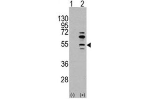 Western blot analysis of MEF2C antibody and 293 cell lysate (2 ug/lane) either nontransfected (Lane 1) or transiently transfected with the MEF2C gene (2).
