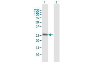 Image no. 2 for anti-Testis-Specific Serine Kinase 3 (TSSK3) (AA 1-268) antibody (ABIN529384)