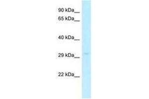 anti-Solute Carrier Family 25 (Mitochondrial Carrier, Ornithine Transporter) Member 15 (SLC25A15) (AA 20-69) antibody