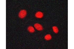 Image no. 3 for anti-Vitamin D Receptor (VDR) (pSer208) antibody (ABIN6255086)