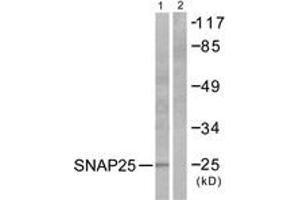 Image no. 1 for anti-Synaptosomal-Associated Protein, 25kDa (SNAP25) (AA 151-200) antibody (ABIN1533400)