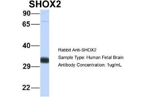 SHOX2 antibody  (N-Term)