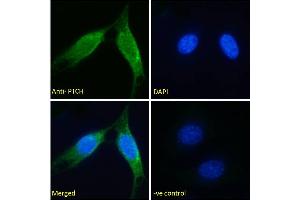 Image no. 1 for anti-Patched 1 (PTCH1) (Internal Region) antibody (ABIN185667)