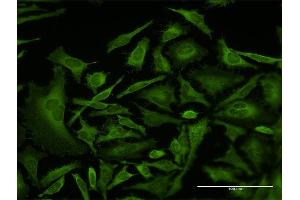 Immunofluorescence of monoclonal antibody to CAP1 on HeLa cell.