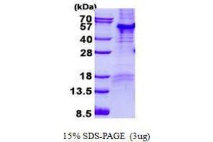 Image no. 1 for Par-6 Partitioning Defective 6 Homolog beta (PARD6B) protein (ABIN2131033)