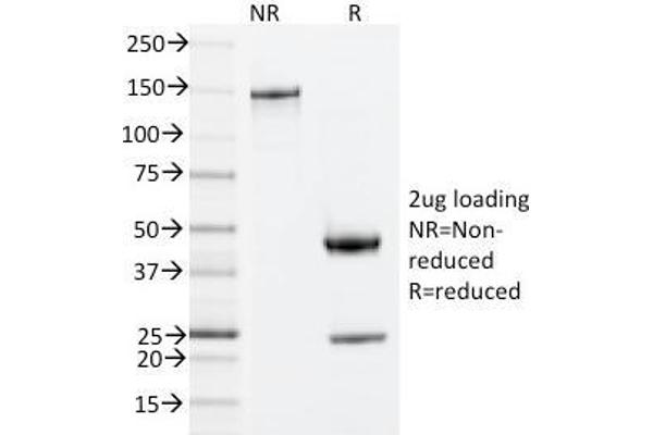 anti-zeta-Chain (TCR) Associated Protein Kinase 70kDa (ZAP70) (AA 247-382) antibody