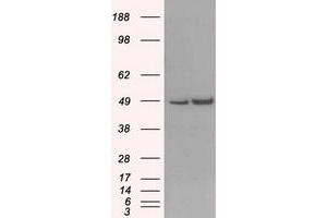 Image no. 2 for anti-LEM Domain Containing 3 (LEMD3) antibody (ABIN1499118)