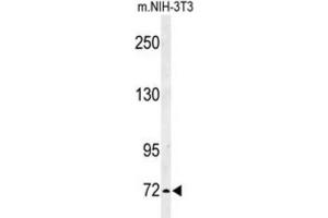 Image no. 3 for anti-Interleukin 1 Receptor Accessory Protein-Like 2 (IL1RAPL2) antibody (ABIN3003924)