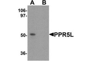 Image no. 1 for anti-Proline Rich 5 Like (PRR5L) (Center) antibody (ABIN783444)