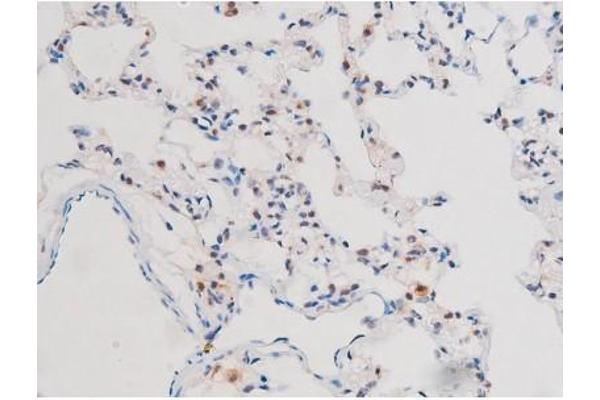 anti-Signal Transducer and Activator of Transcription 3 (Acute-Phase Response Factor) (STAT3) (pSer727) antibody