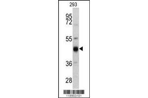 Image no. 1 for anti-Keratin 13 (KRT13) (AA 106-138), (N-Term) antibody (ABIN390662)
