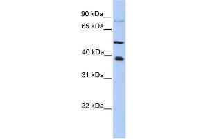 Image no. 1 for anti-Methyltransferase Like 2B (METTL2B) (N-Term) antibody (ABIN2783523)