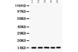 Image no. 5 for anti-Fatty Acid Binding Protein 1, Liver (FABP1) (AA 6-36), (N-Term) antibody (ABIN3042384)