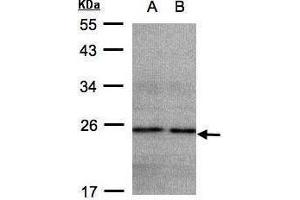 anti-NADH Dehydrogenase (Ubiquinone) 1 beta Subcomplex, 9, 22kDa (NDUFB9) (Center) antibody