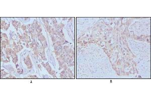 anti-Epidermal Growth Factor (EGF) antibody