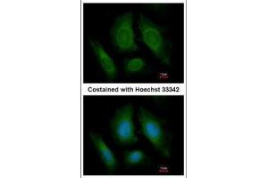 Image no. 2 for anti-Oxysterol Binding Protein-Like 6 (OSBPL6) (C-Term) antibody (ABIN2856531)