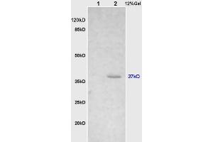 Image no. 5 for anti-Cathepsin H (CTSH) (AA 71-170) antibody (ABIN732758)