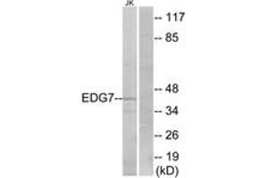 Image no. 2 for anti-Lysophosphatidic Acid Receptor 3 (LPAR3) (AA 111-160) antibody (ABIN1535593)