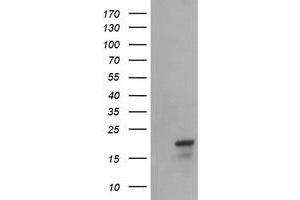 Image no. 4 for anti-NADH Dehydrogenase (Ubiquinone) 1 beta Subcomplex, 10, 22kDa (NDUFB10) antibody (ABIN1499669)