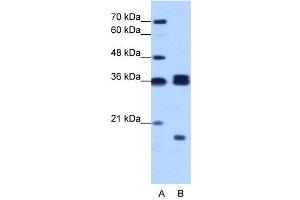 Image no. 3 for anti-Heterogeneous Nuclear Ribonucleoprotein H3 (2H9) (HNRNPH3) (N-Term) antibody (ABIN2779031)