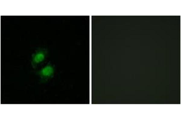 anti-Zinc Finger Protein 95 (ZNF95) (AA 291-340) antibody