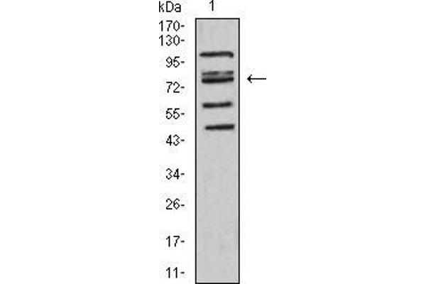 FOXP2 anticorps  (AA 641-740)