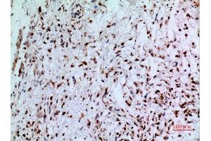 Image no. 5 for anti-HLA-DR-gamma (CD74) (Internal Region) antibody (ABIN3187958)