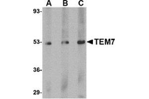 Image no. 2 for anti-Plexin Domain Containing 1 (PLXDC1) (C-Term) antibody (ABIN500899)