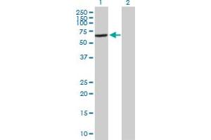 Image no. 1 for anti-Vacuolar Protein Sorting 45 (VPS45) (AA 1-570) antibody (ABIN524719)
