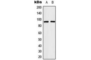 Image no. 2 for anti-Transcription Elongation Factor B (SIII), Polypeptide 3 (110kDa, Elongin A) (TCEB3) (Center) antibody (ABIN2707151)