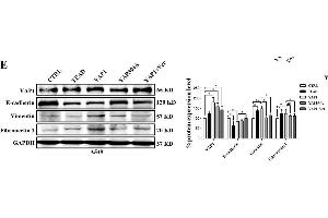 Image no. 7 for anti-Glyceraldehyde-3-Phosphate Dehydrogenase (GAPDH) antibody (ABIN3020541)
