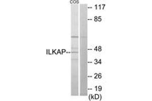 Image no. 1 for anti-Integrin-Linked Kinase-Associated Serine/threonine Phosphatase 2C (ILKAP) (AA 41-90) antibody (ABIN1534114)