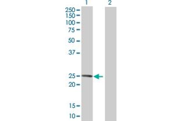 anti-Leucine Rich Repeat Containing 29 (LRRC29) (AA 1-223) antibody