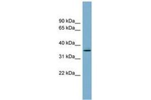 Image no. 1 for anti-Acyl-CoA Wax Alcohol Acyltransferase 1 (AWAT1) (AA 107-156) antibody (ABIN6743322)