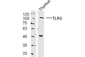 Image no. 2 for anti-Toll-Like Receptor 6 (TLR6) (AA 301-400) antibody (ABIN749573)