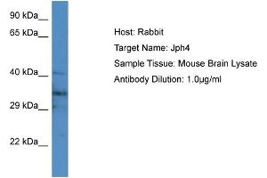 Image no. 1 for anti-Junctophilin 4 (JPH4) (Middle Region) antibody (ABIN2783782)