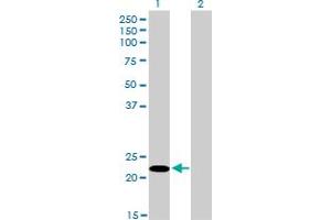 Image no. 7 for anti-serine/arginine-Rich Splicing Factor 10 (SRSF10) (AA 1-100) antibody (ABIN564697)