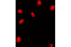 Immunofluorescent analysis of HOXA11/D11 staining in HeLa cells.