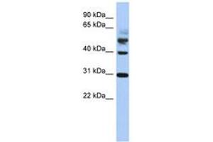 Image no. 1 for anti-Tubulin tyrosine Ligase (TTL) (AA 215-264) antibody (ABIN6743729)