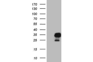 Image no. 3 for anti-Amelotin (AMTN) antibody (ABIN2716039)