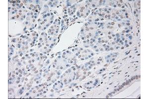 Image no. 3 for anti-Vascular Endothelial Growth Factor (VEGF) (AA 27-233) antibody (ABIN2735207)