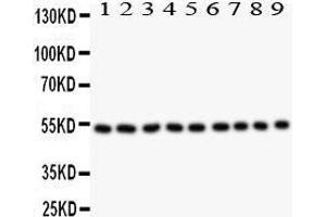 Image no. 2 for anti-Desmin (DES) (AA 1-304) antibody (ABIN3043265)