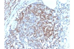 Image no. 3 for anti-CD6 (CD6) antibody (ABIN6941064)