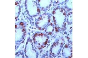 Image no. 1 for anti-Gastrin (GAST) (N-Term) antibody (ABIN373480)