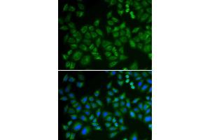 Image no. 3 for anti-Sphingomyelin phosphodiesterase 1, Acid Lysosomal (SMPD1) antibody (ABIN6148144)